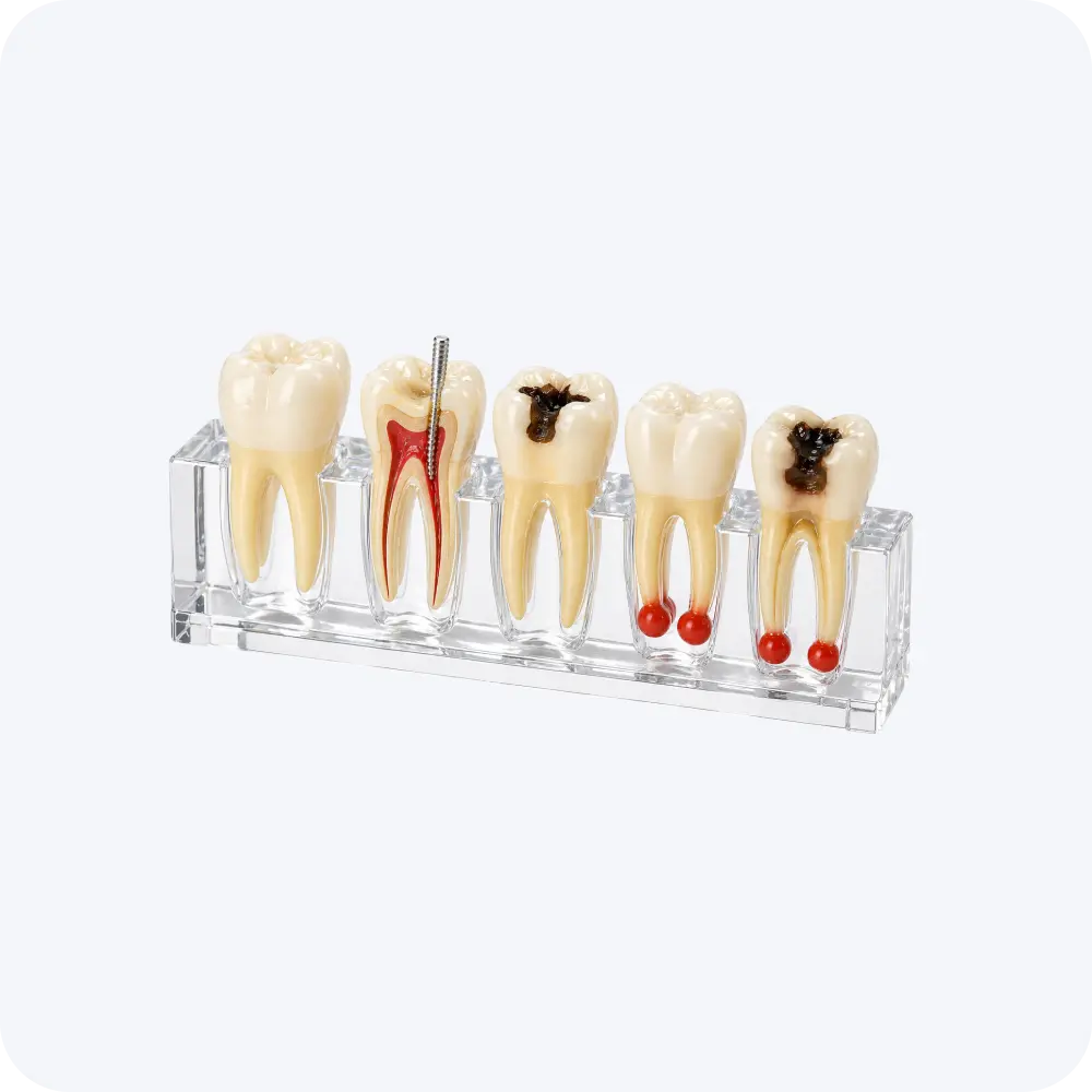 iDENTical Root Canal Model M4012